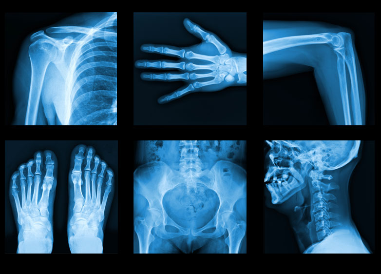 xray images